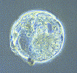 Embryon humain (4ème jour) - L'embryon compte alors 64 cellules et une cavité liquidienne se creuse au sein de celui-ci, qui est alors appelé blastocyste. A ce stade, l'embryon est formé de 2 types de cellules: les cellules de la périphérie ou cellules du trophoblaste qui donneront les annexes de l'embryon (placenta) et les cellules de la masse cellulaire interne qui donneront l'embryon lui-même.